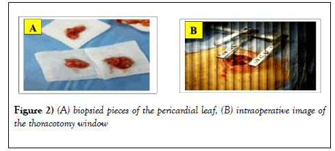 clinical-cardiology-journal-intraoperative