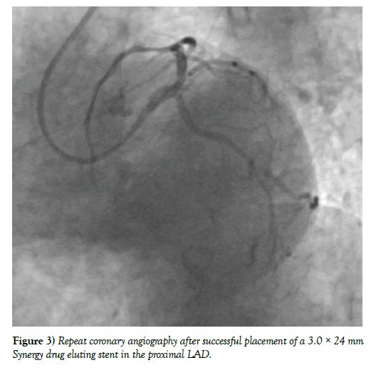 clinical-cardiology-journal-placement