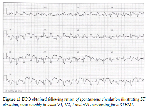 clinical-cardiology-journal-spontaneous