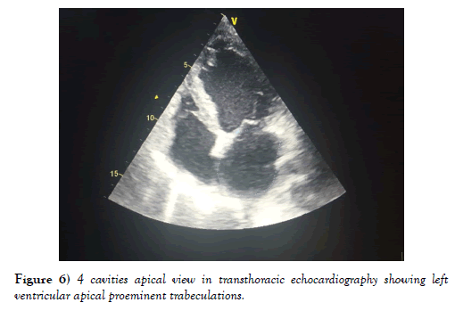 clinical-cardiology-journal-transthoracic