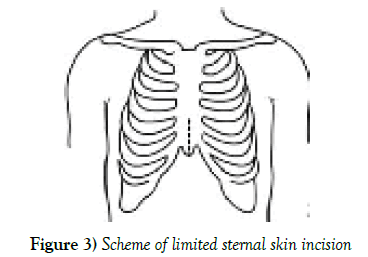 clinical-cardiology-skin-incision