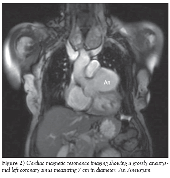 current-research-cardiology-Cardiac-magnetic