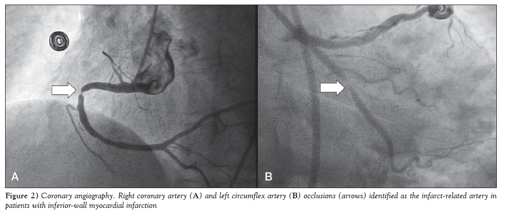 current-research-cardiology-Coronary-angiography