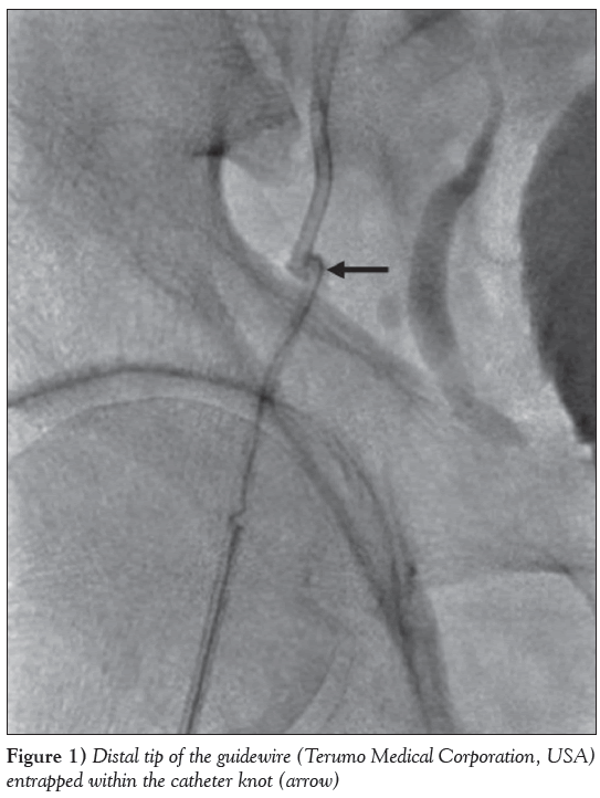 current-research-cardiology-Distal-tip