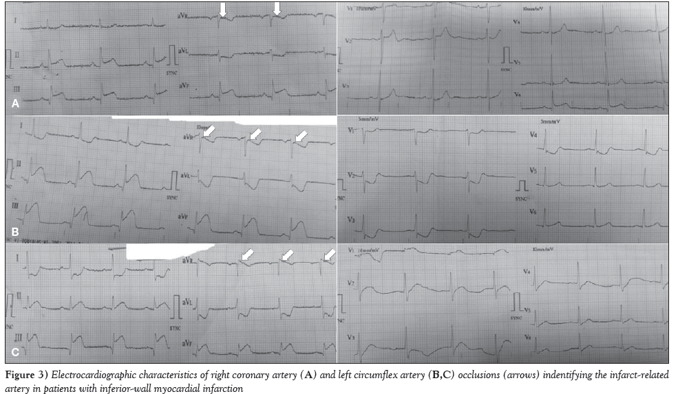 current-research-cardiology-Electrocardiographic