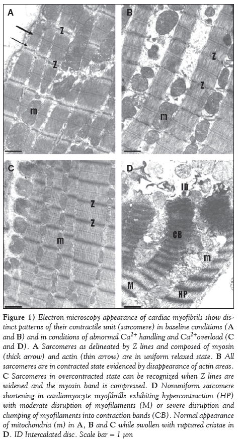 current-research-cardiology-Electron-microscopy