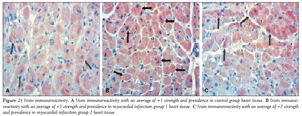 current-research-cardiology-Irisin-immunoreactivity