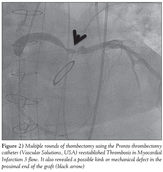 current-research-cardiology-Multiple-rounds