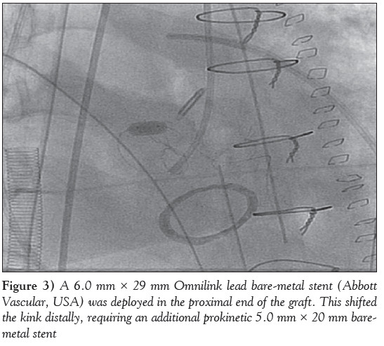 current-research-cardiology-Omnilink-lead