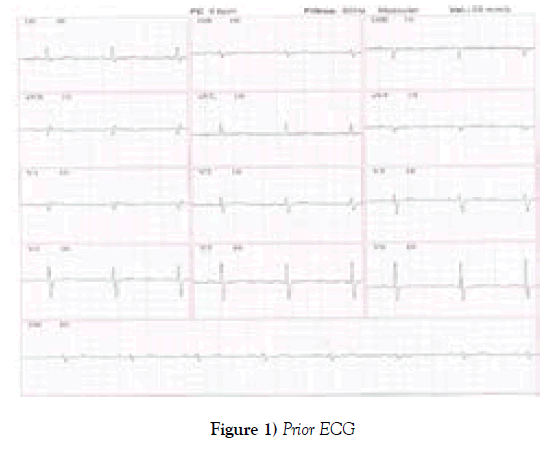 current-research-cardiology-Prior-ECG