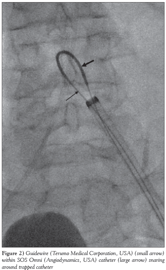 current-research-cardiology-Terumo-Medical