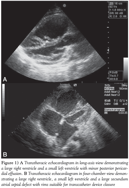 current-research-cardiology-Transthoracic-echocardiogram