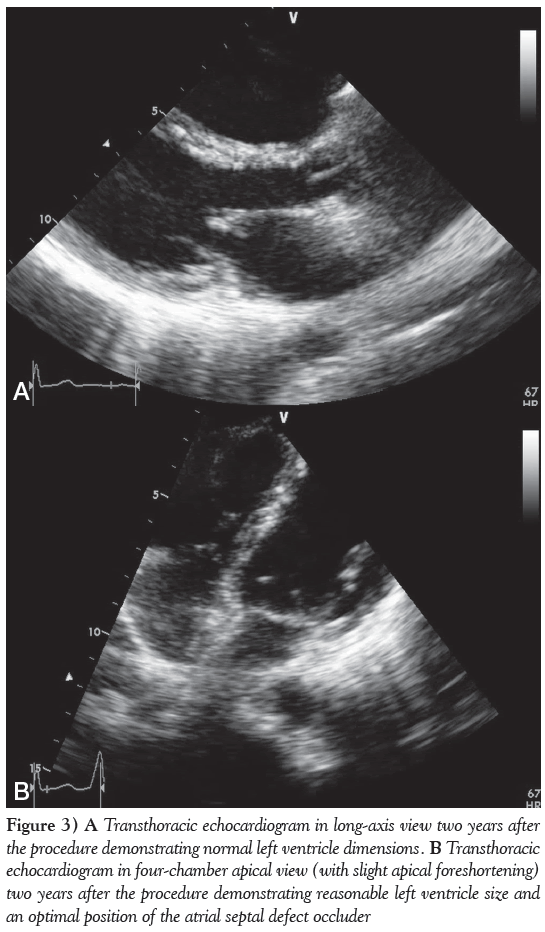 current-research-cardiology-Transthoracic-echocardiogram