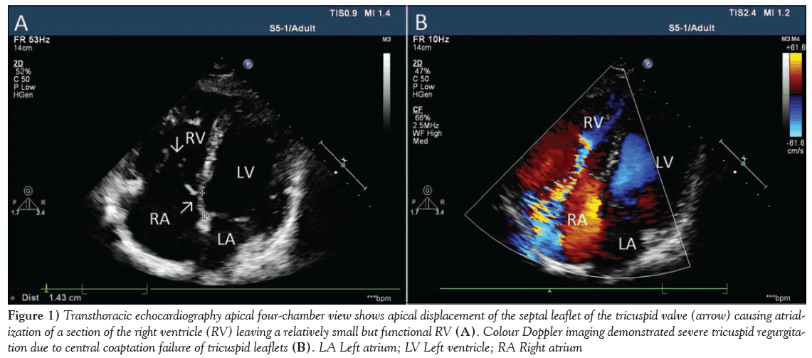 current-research-cardiology-Transthoracic-echocardiography