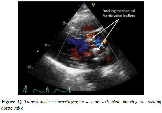current-research-cardiology-Transthoracic-echocardiography