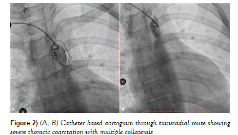current-research-cardiology-aortogram