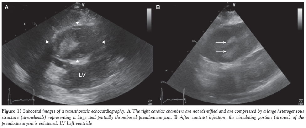 current-research-cardiology-cardiac-chambers