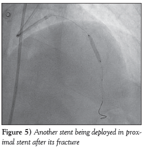 current-research-cardiology-deployed-fractured