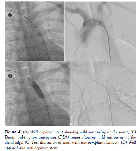 current-research-cardiology-dilatation