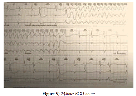 current-research-cardiology-ecg-holter