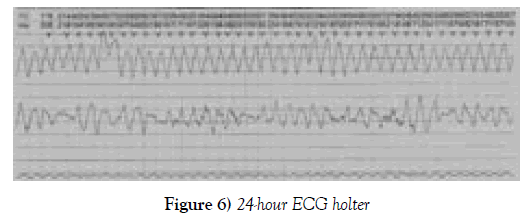 current-research-cardiology-ecg-holter