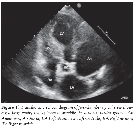 current-research-cardiology-five-chamber