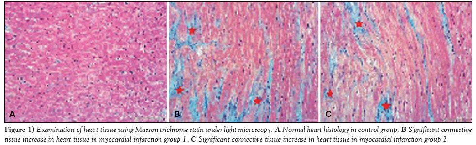 current-research-cardiology-heart-tissue-myocardial-infarction