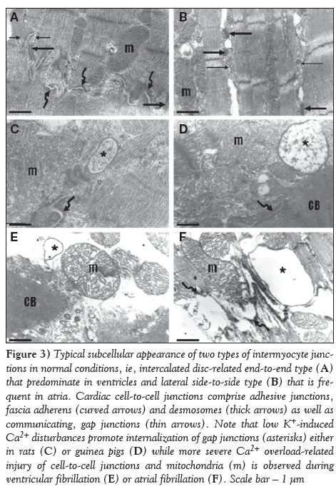 current-research-cardiology-intercalated-disc-related