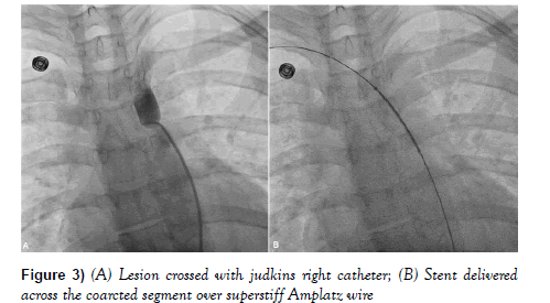 current-research-cardiology-judkins