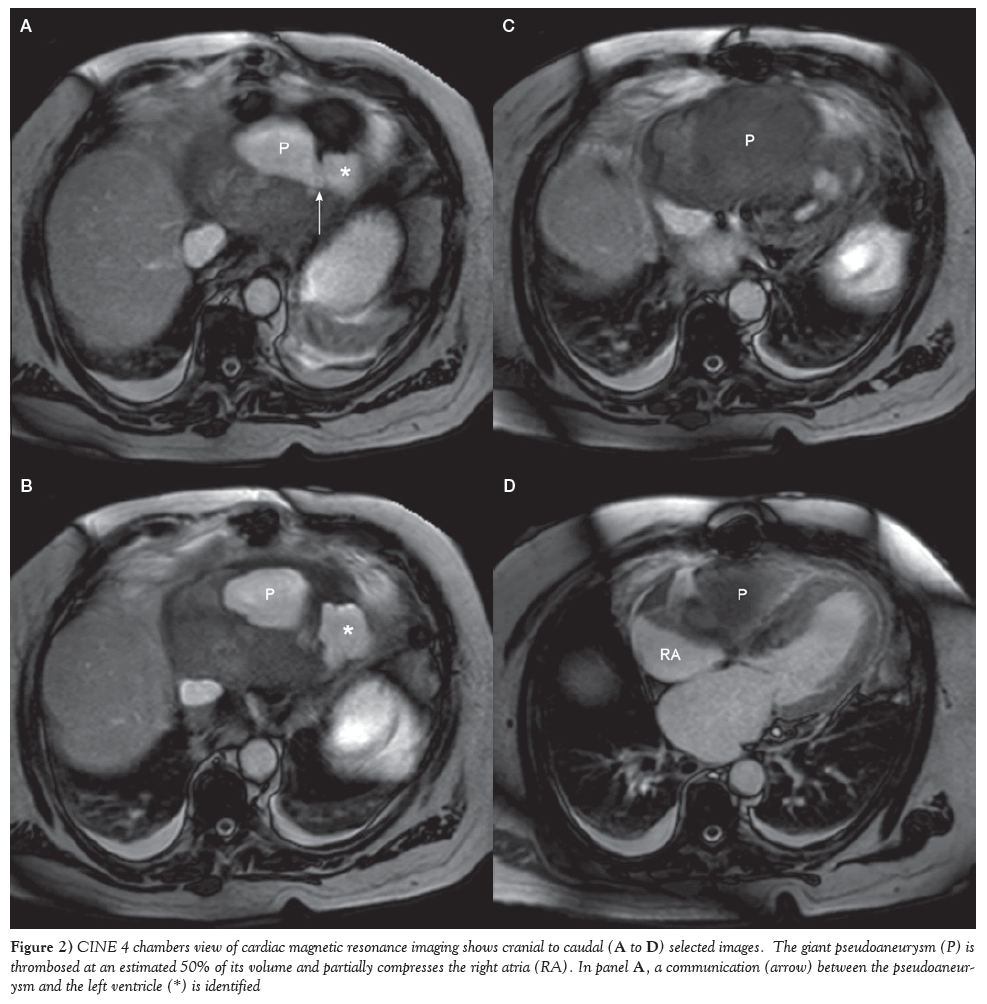 current-research-cardiology-magnetic-resonance