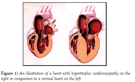 current-research-cardiology-normal-heart