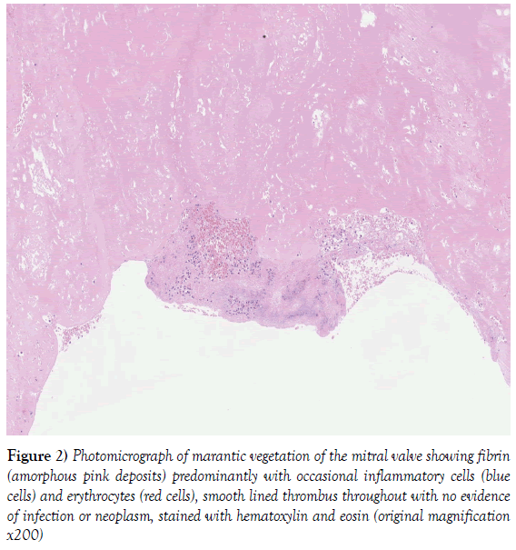 current-research-cardiology-occasional-inflammatory