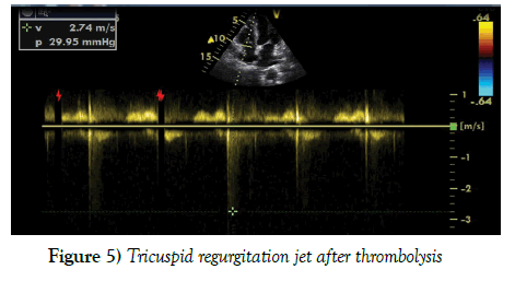 current-research-cardiology-regurgitation