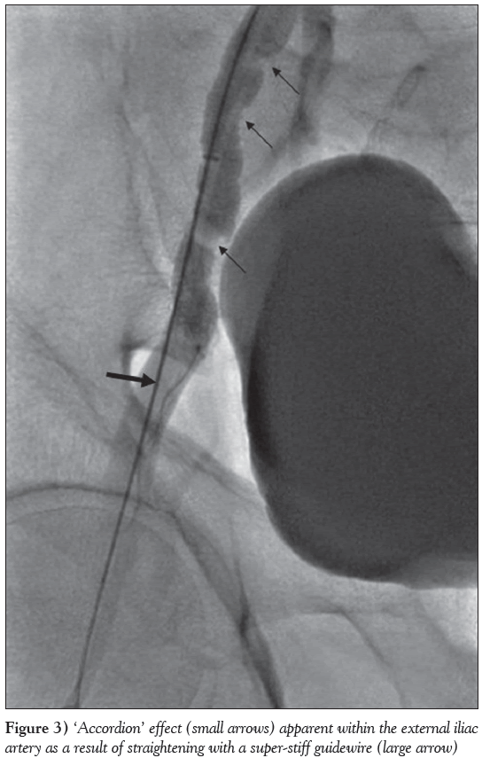 current-research-cardiology-result-straightening