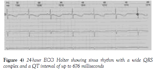 current-research-cardiology-sinus-rhythm