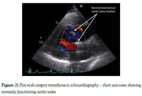 current-research-cardiology-surgery-transthoracic