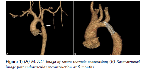 current-research-cardiology-thoracic