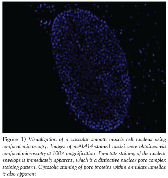 current-research-cardiology-vascular-smooth-muscle