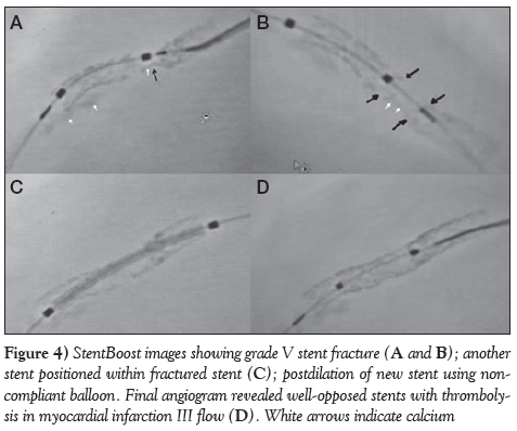 current-research-cardiology-within-fractured