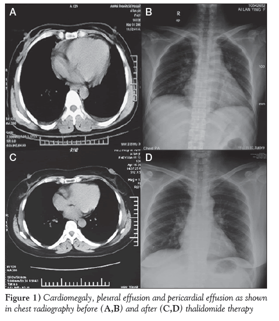 current-research-integrative-medicine-Cardiomegaly-pleural-effusion