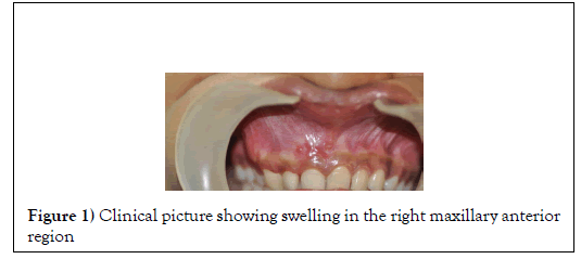 dental-oral-maxillary-anterior