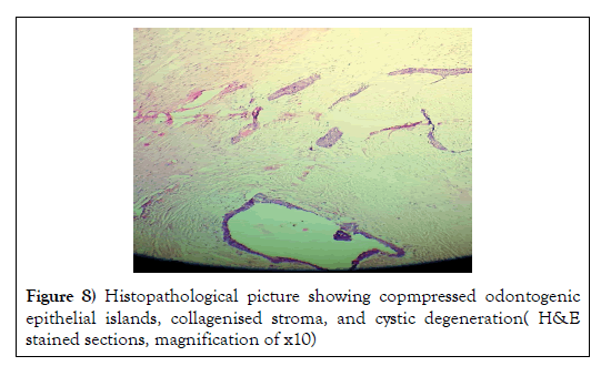 dental-oral-odontogenic