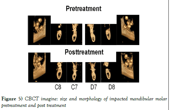 dentistry-CBCT-imagine