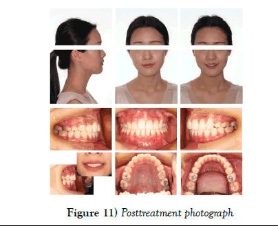 dentistry-Posttreatment