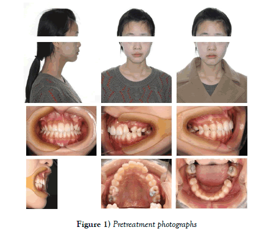 dentistry-Pretreatment-photographs