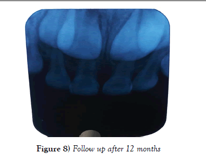 dentistry-after-months