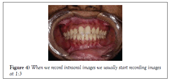 dentistry-case-report-intraoral