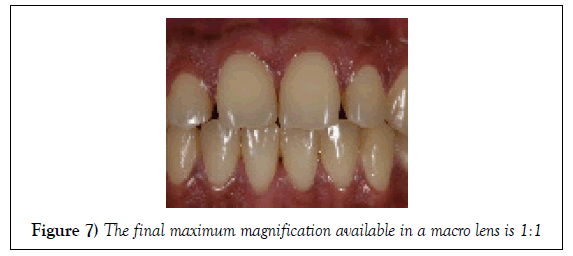 dentistry-case-report-macro-lens