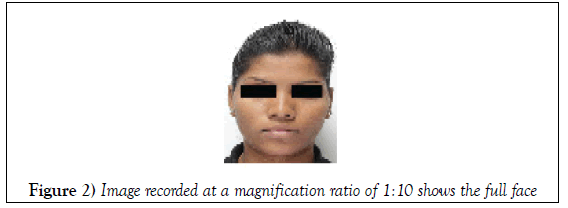 dentistry-case-report-magnification