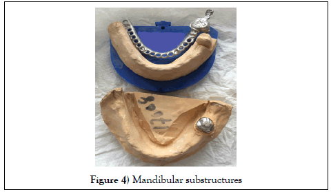 dentistry-case-report-mandibular